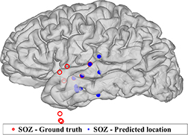 Seizure onset zone (SOZ) identification using effective brain ...