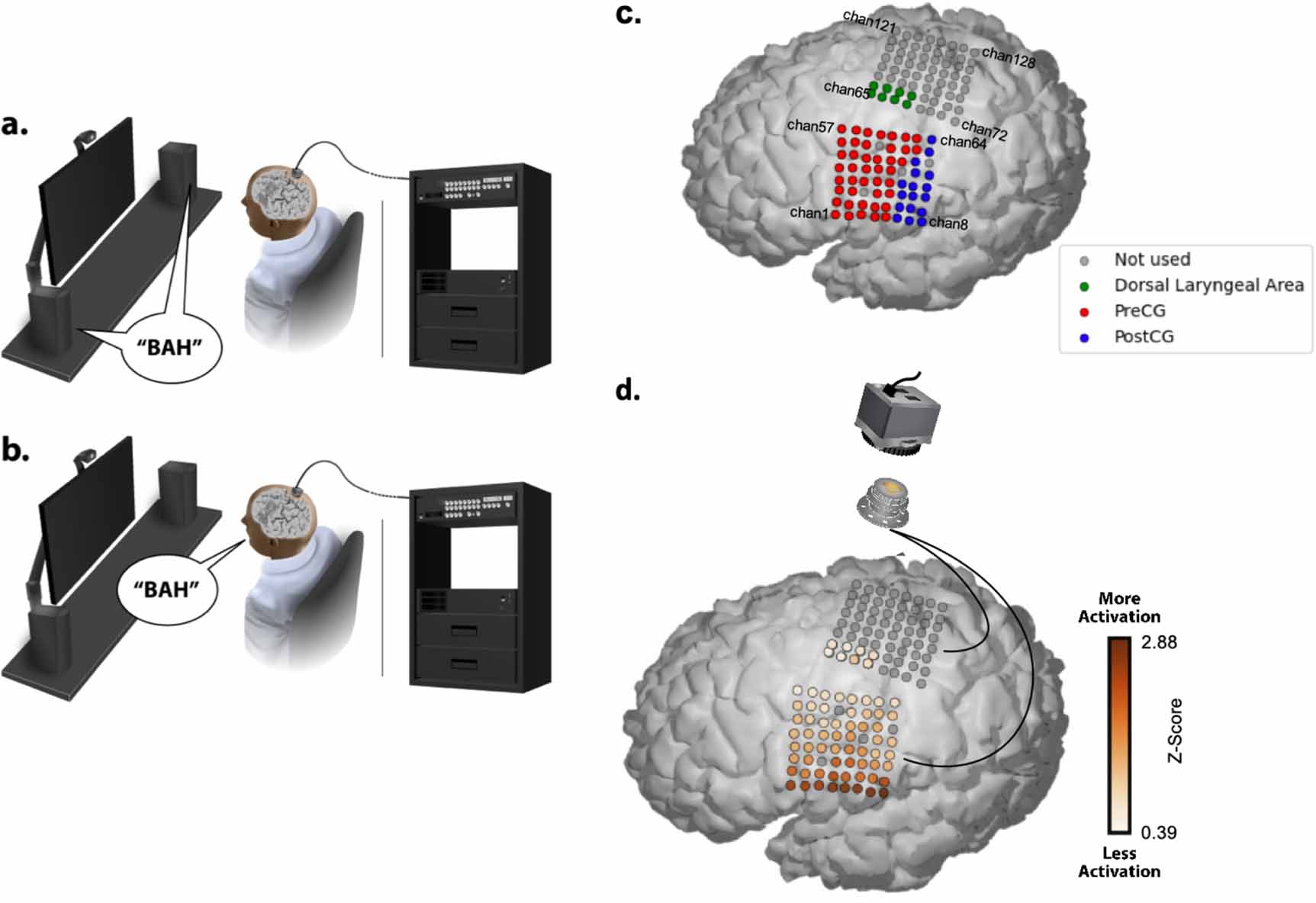 Stability of ECoG high gamma signals during speech and implications for ...