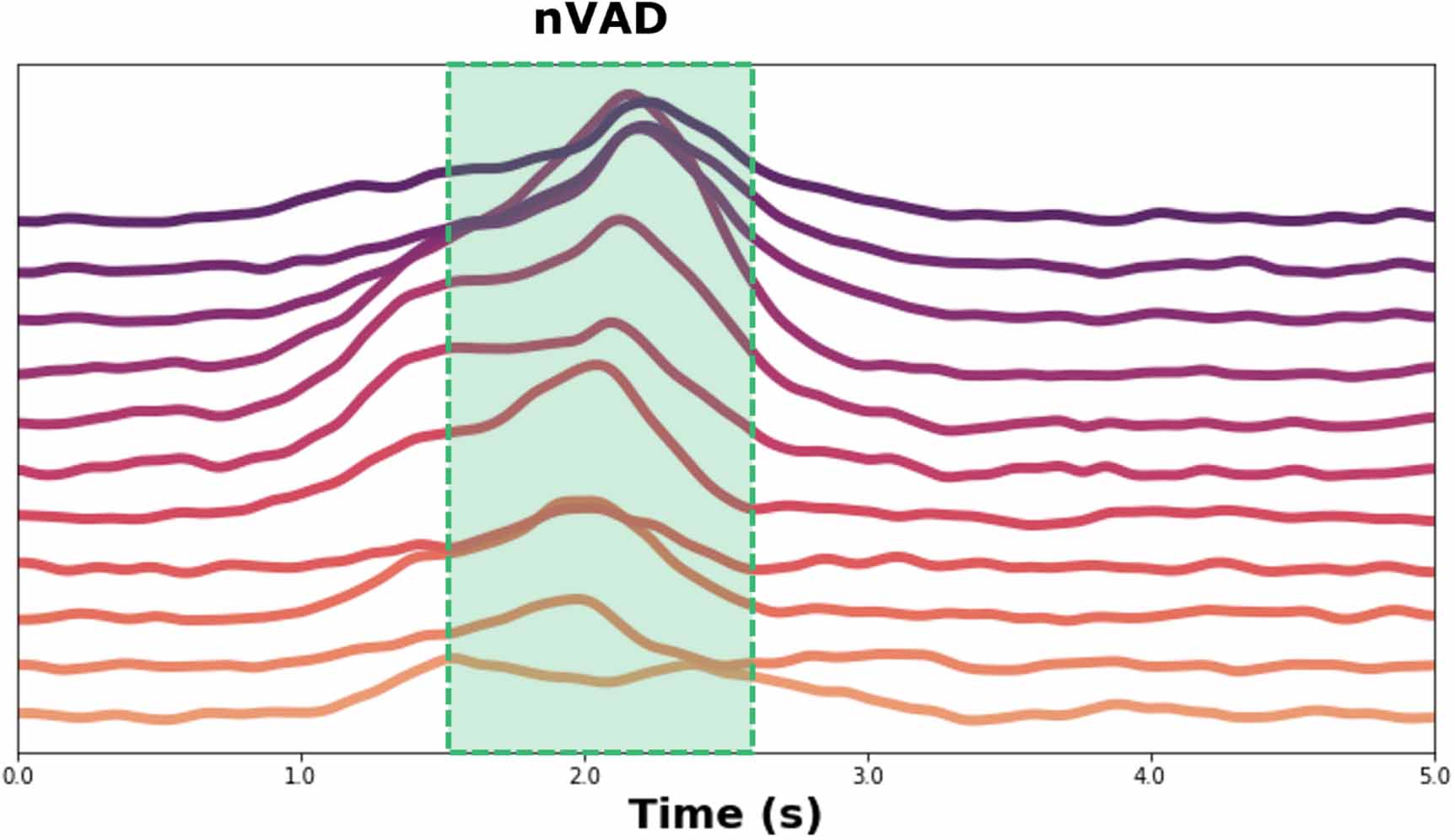 Iterative alignment discovery of speech-associated neural activity ...