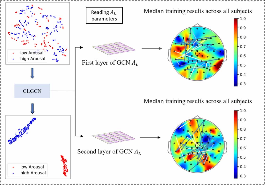 Emotion recognition of EEG signals based on contrastive learning graph ...