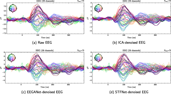 Clean Eeg Data Integrating spatial and temporal features for enhanced artifact removal ...