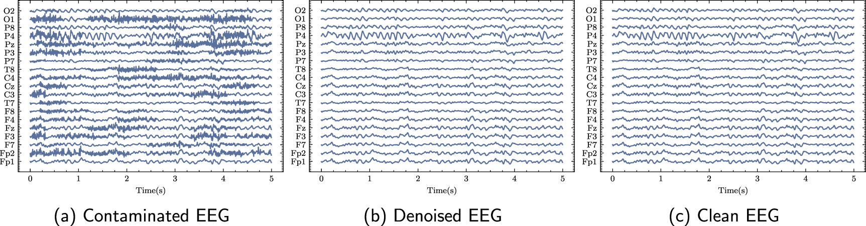 Clean Eeg Data Integrating spatial and temporal features for enhanced artifact removal ...