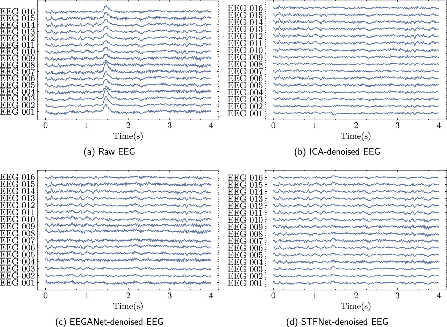 Clean Eeg Data Integrating spatial and temporal features for enhanced artifact removal ...