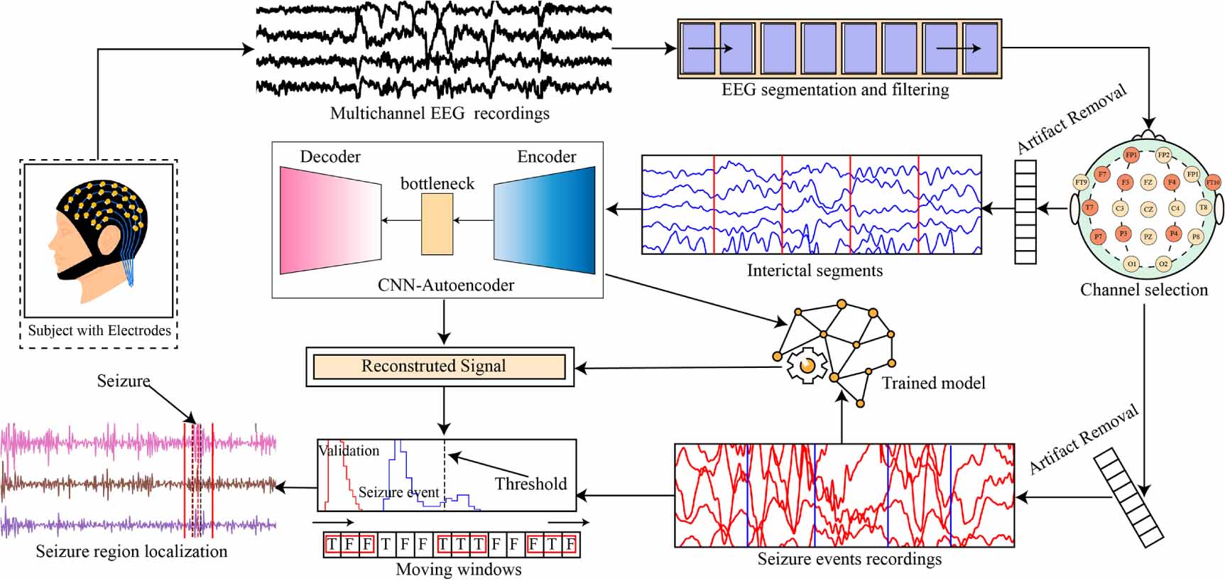 Automatic detection of epileptic seizure based on one dimensional ...