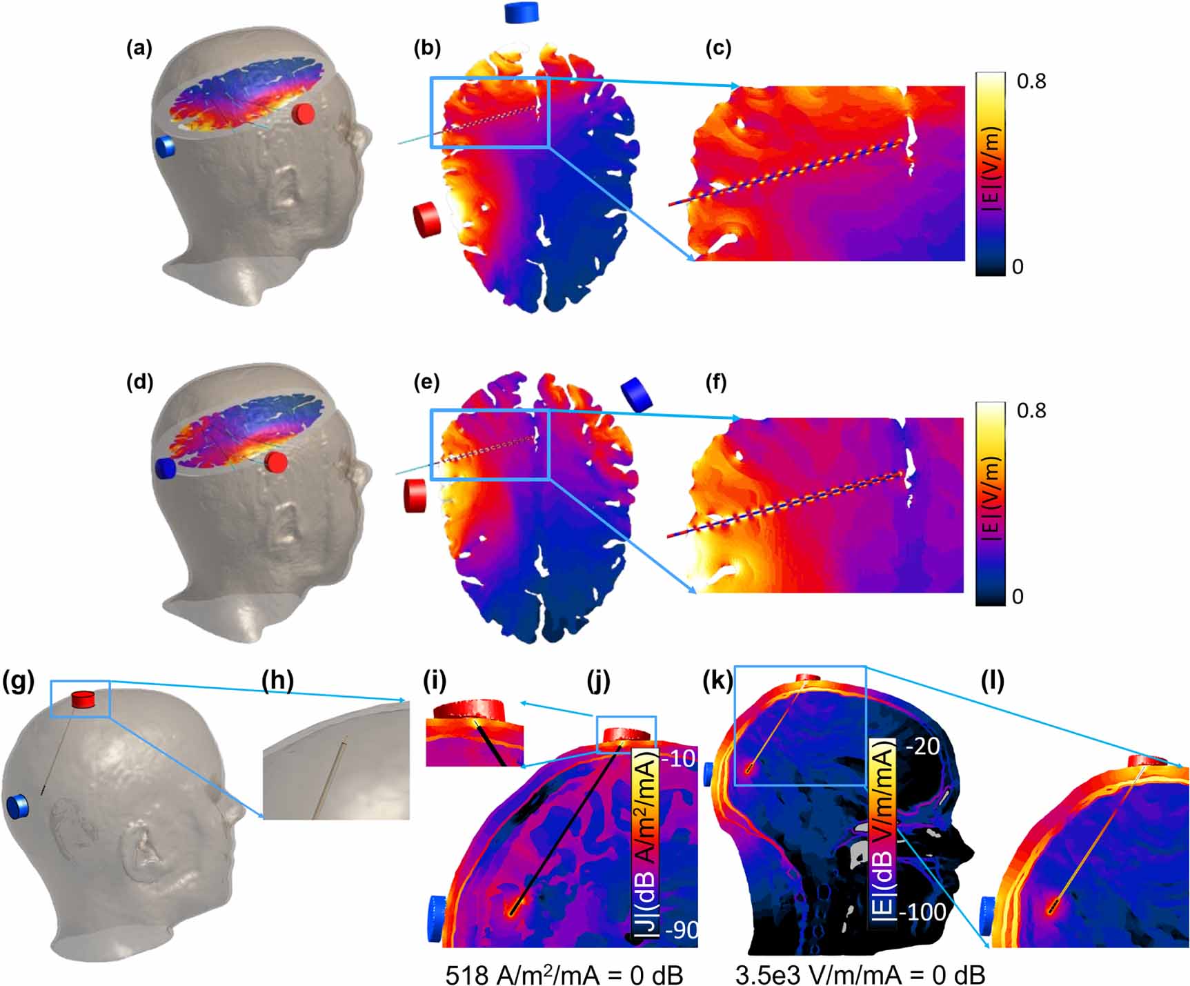 Python Non Invasive Brain Stimulation Simulation Safety of non-invasive brain stimulation in patients with implants: a ...