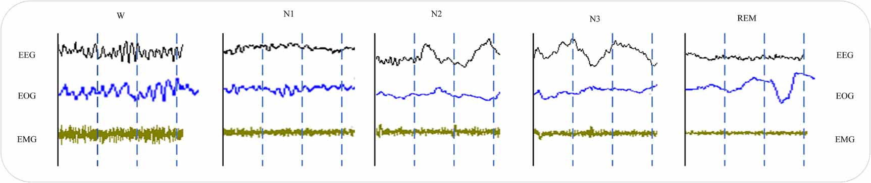 GraphSleepFormer: a multi-modal graph neural network for sleep staging ...