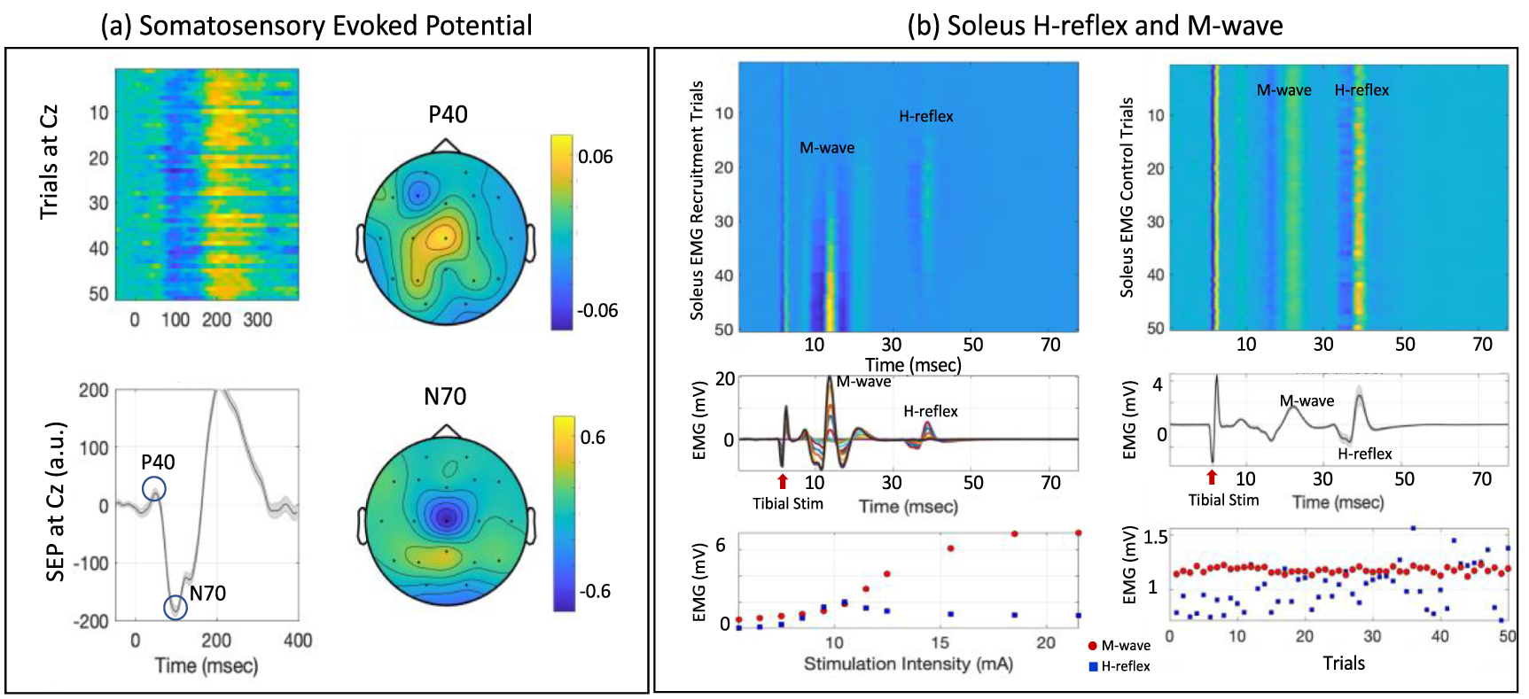 Frequency dependence of cortical somatosensory evoked response to ...