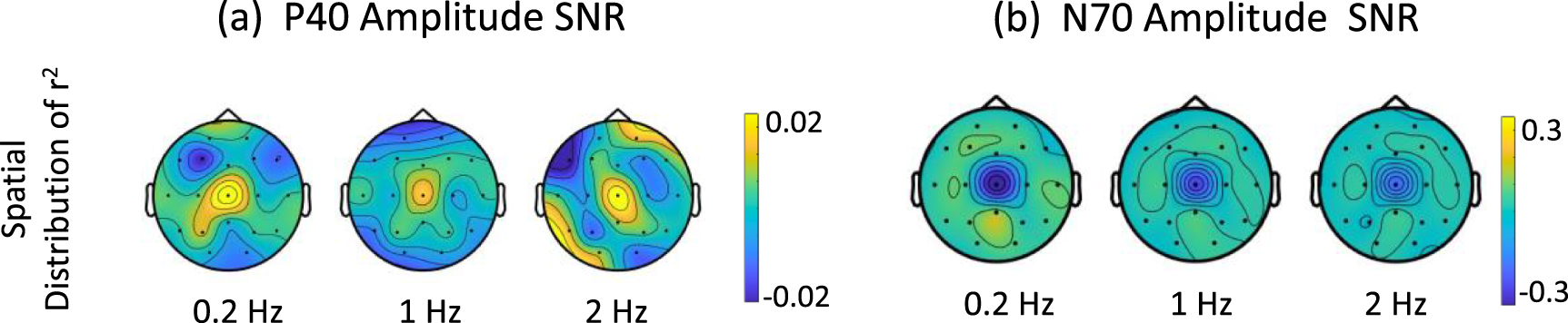 Frequency dependence of cortical somatosensory evoked response to ...