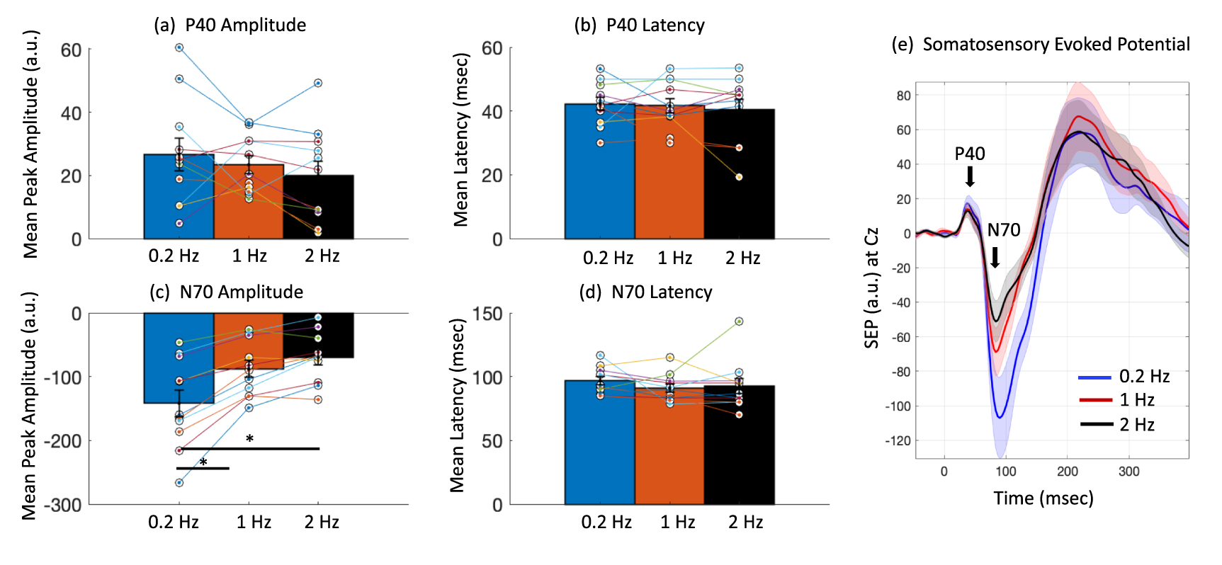 Frequency dependence of cortical somatosensory evoked response to ...