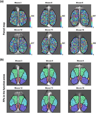 Unveiling functional heterogeneity in anatomical functional areas: a ...