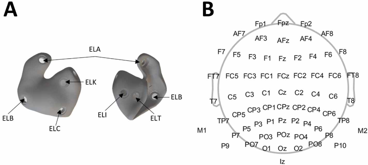 The speech reception threshold can be estimated using EEG electrodes in ...