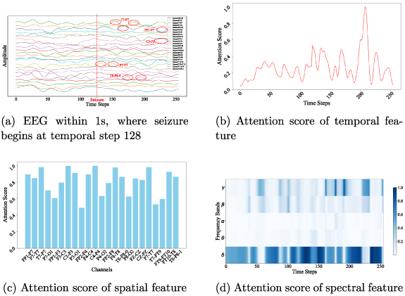 Feature fusion based on global-local weighted attention model for ...