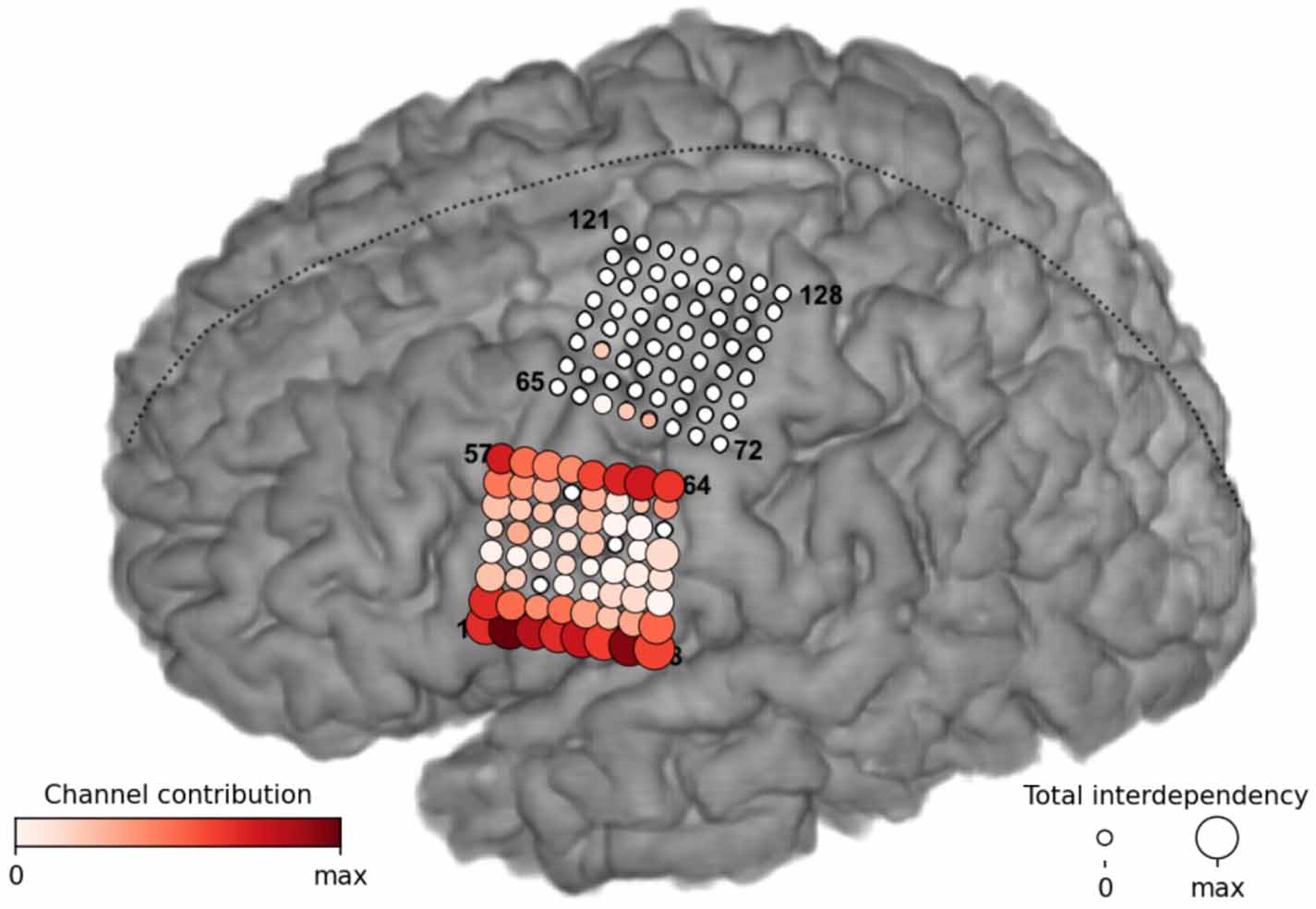 Sentence Processing Ecog Real-time detection of spoken speech from unlabeled ECoG signals: a ...