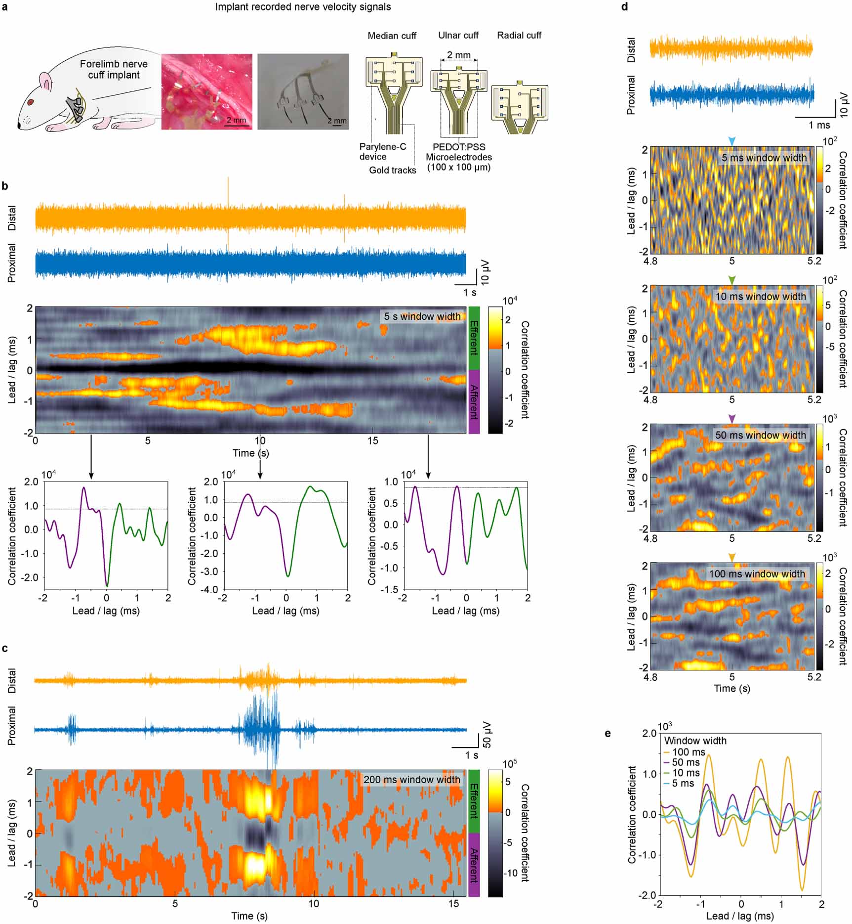 Development of novel signal and spike velocity analysis tools in ...