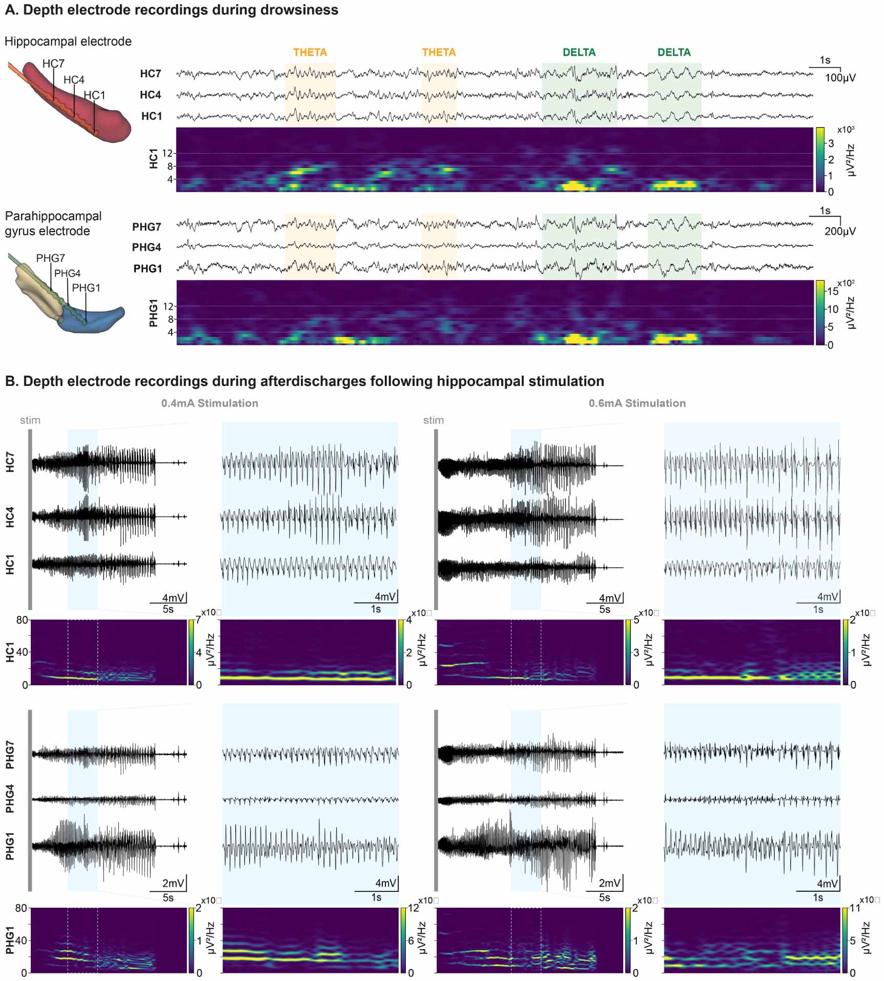 High-accuracy electrode implantation in deep brain structures using ...