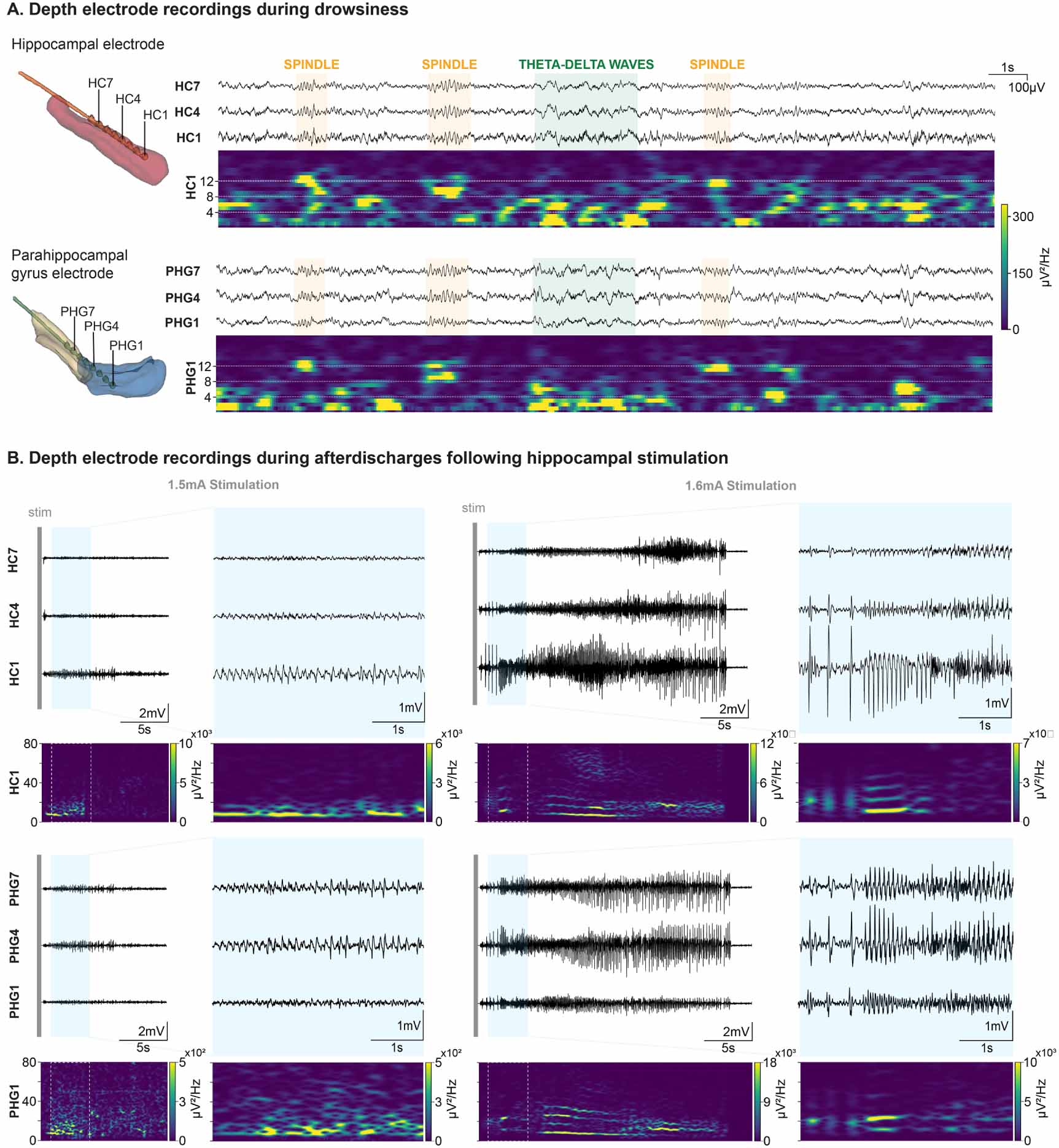 High-accuracy electrode implantation in deep brain structures using ...