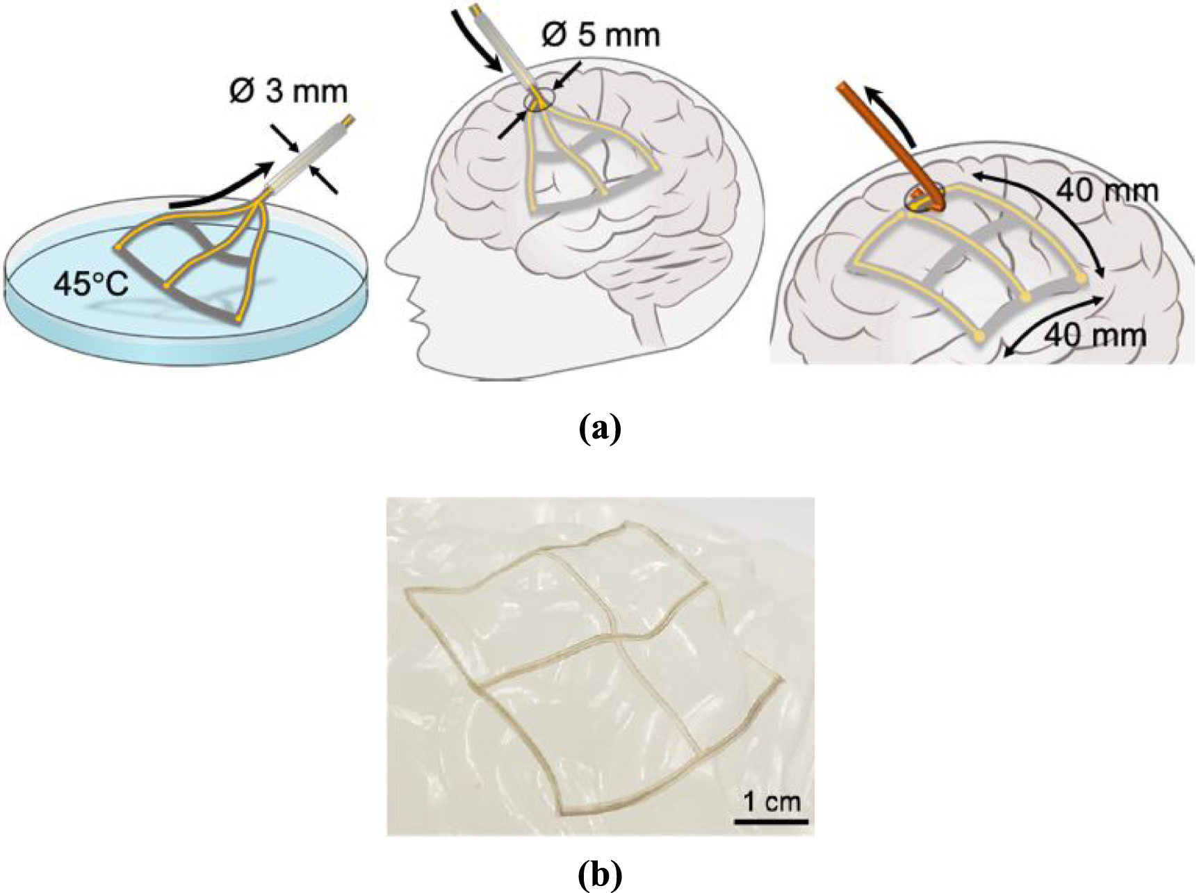 Deployable electrode arrays for brain interfaces: structural ...