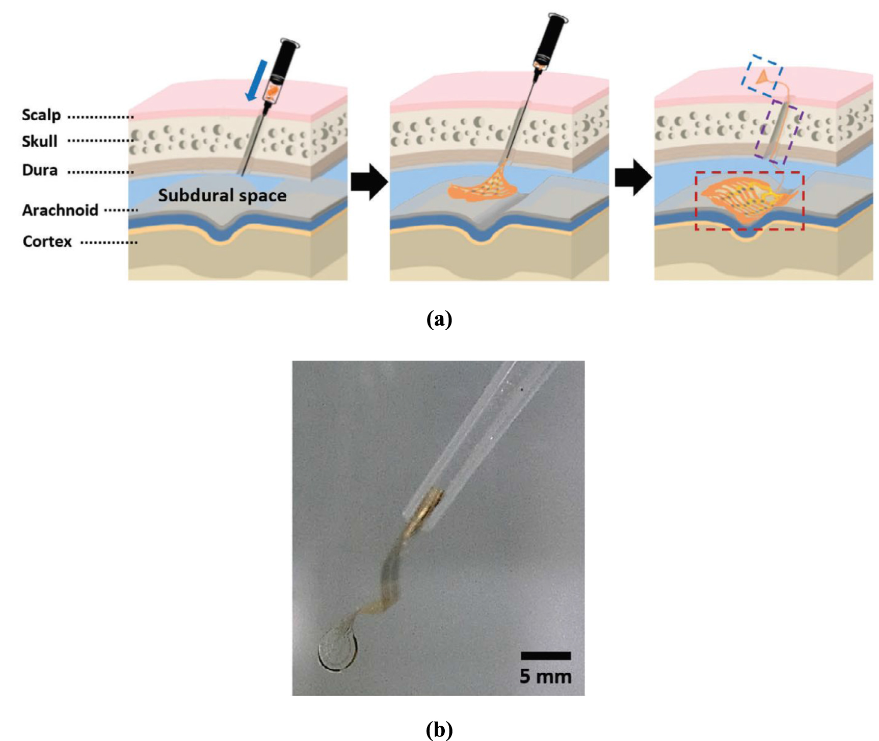 Deployable electrode arrays for brain interfaces: structural ...