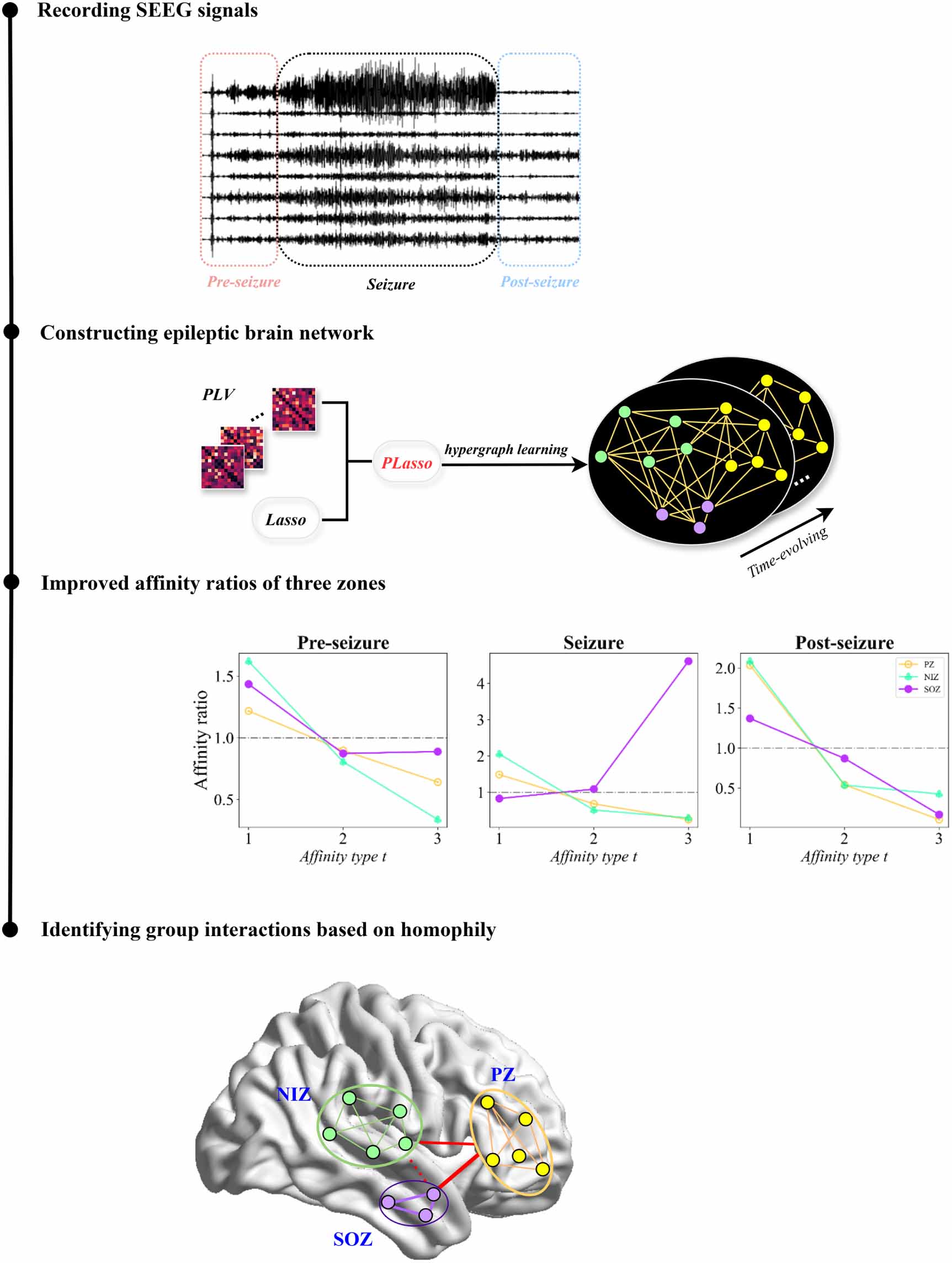 Evaluating group interactions in epileptic brain networks by hypergraph ...