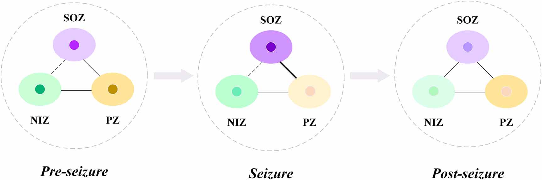Evaluating group interactions in epileptic brain networks by hypergraph ...