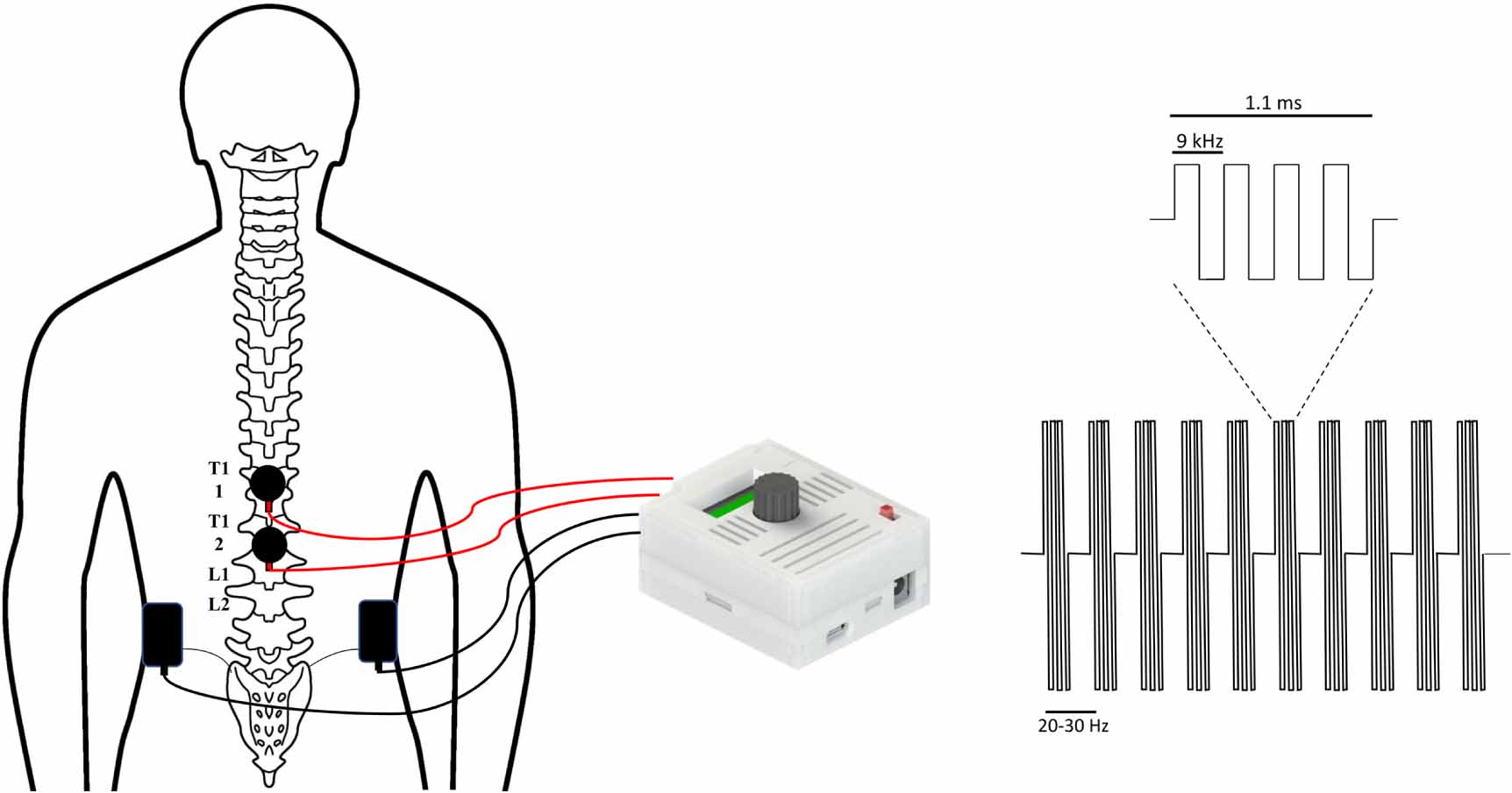 Programable Electrical Stim OpenXstim: an open-source programmable electrical stimulator for ...