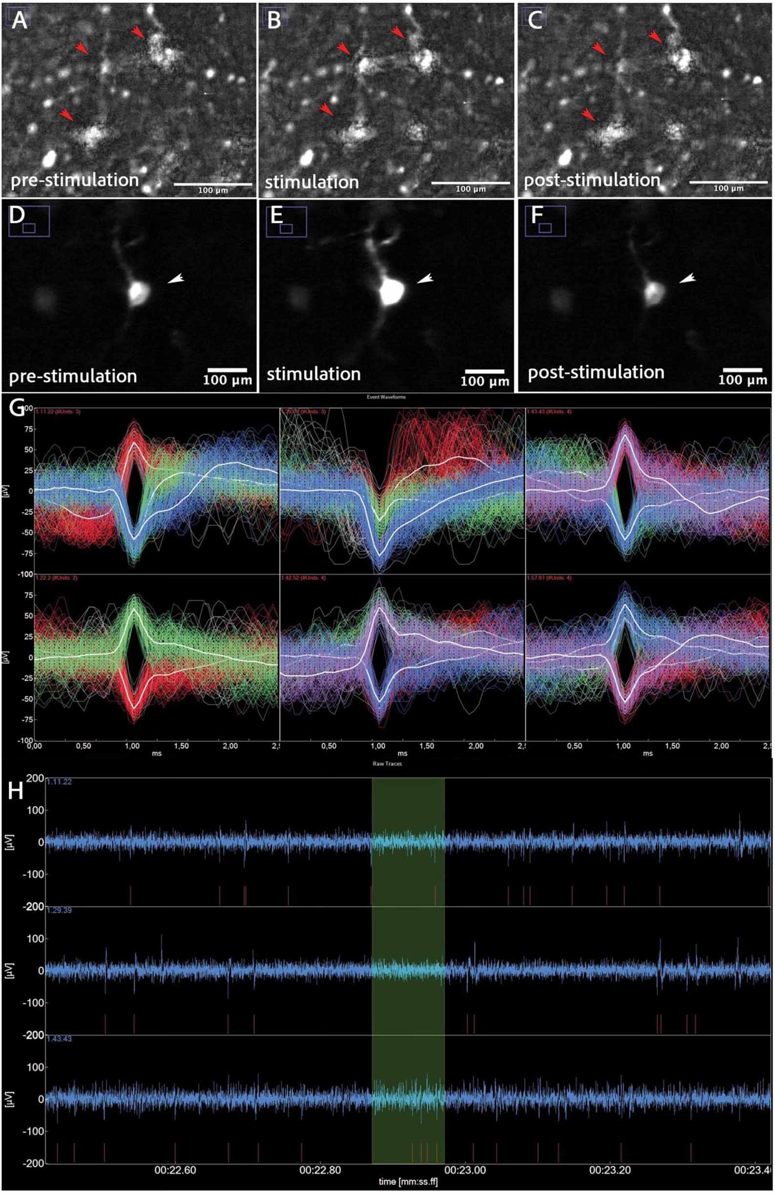 Organotypic human brain slice cultures as a translational testing ...