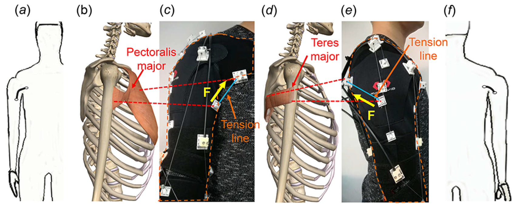 Bio-inspired upper limb soft exoskeleton to reduce stroke-induced ...