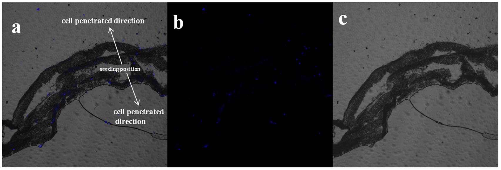 A vascular tissue engineering scaffold with core–shell structured nano ...