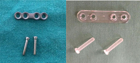 Does the Inion OTPSTM absorbable plating system induce higher foreign ...