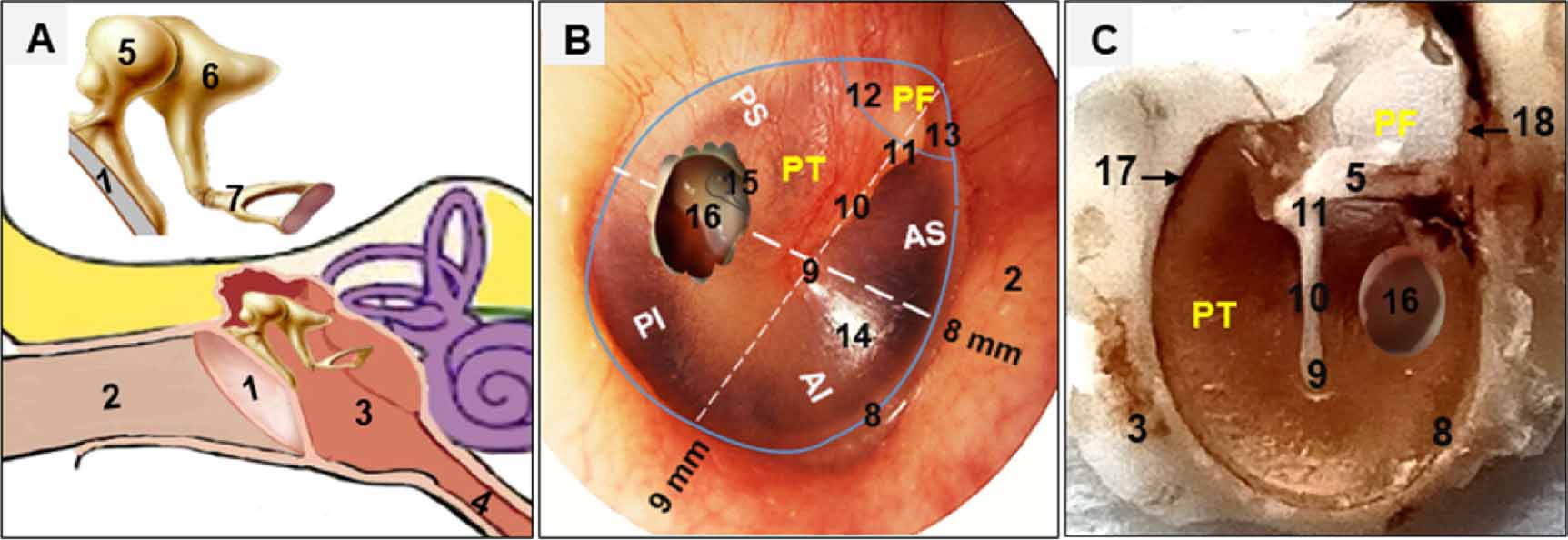 Necessities, opportunities, and challenges for tympanic membrane ...