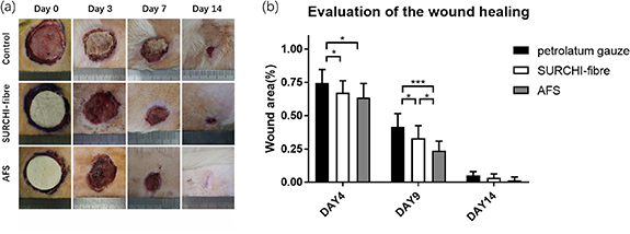 Acellular fish skin enhances wound healing by promoting angiogenesis ...