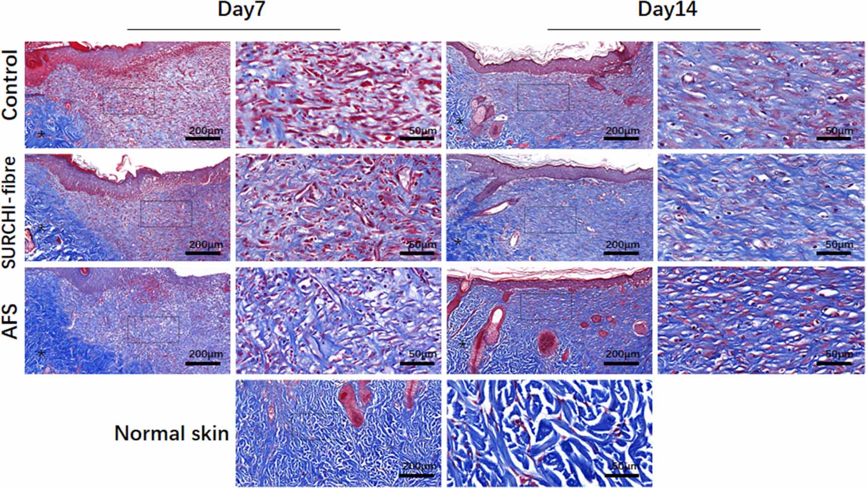 Acellular fish skin enhances wound healing by promoting angiogenesis ...