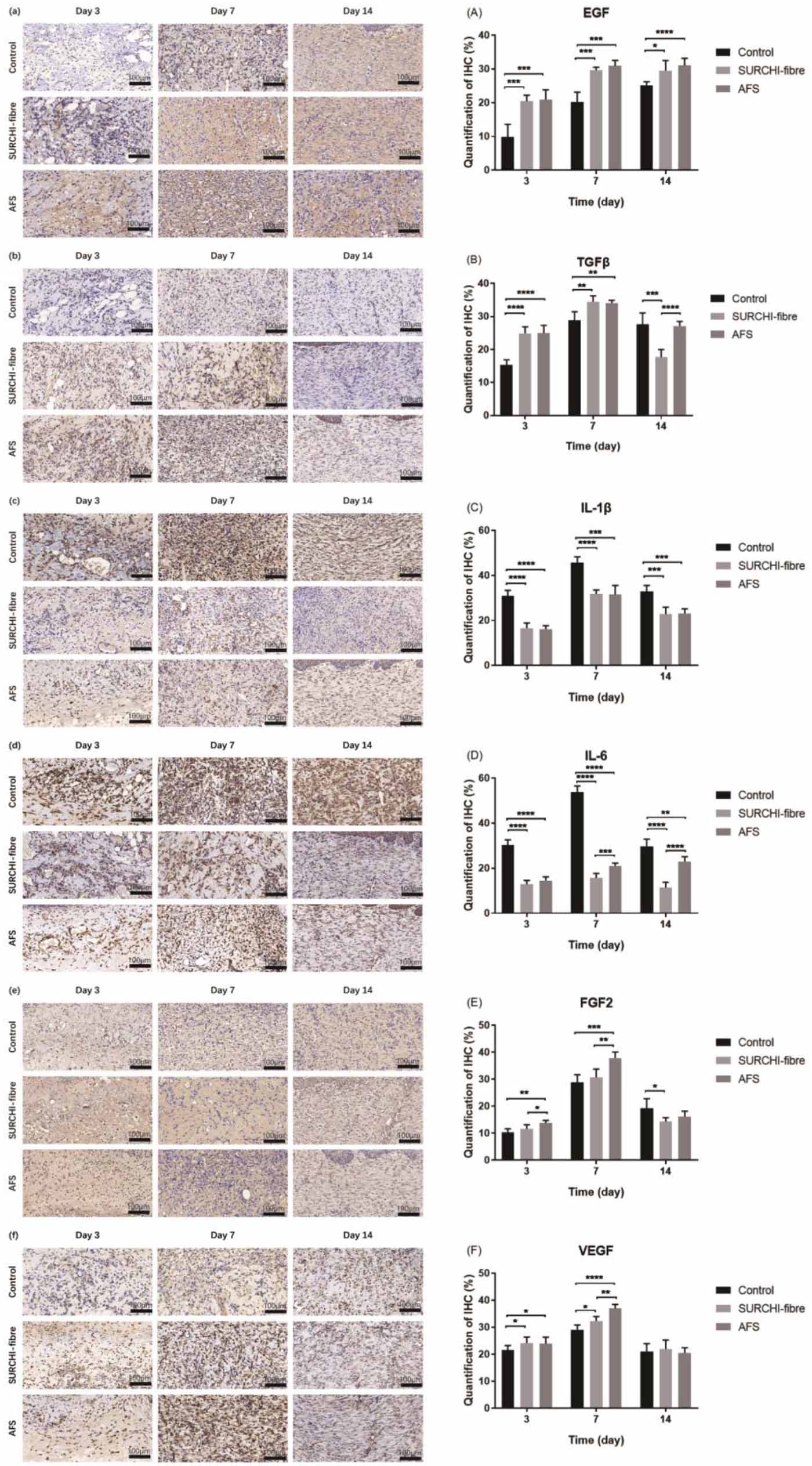 Acellular fish skin enhances wound healing by promoting angiogenesis ...