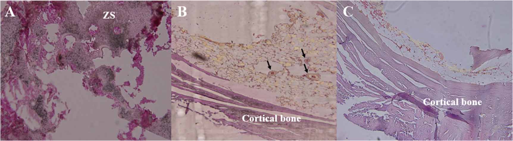 Improvement of mechanical properties of zein porous scaffold
