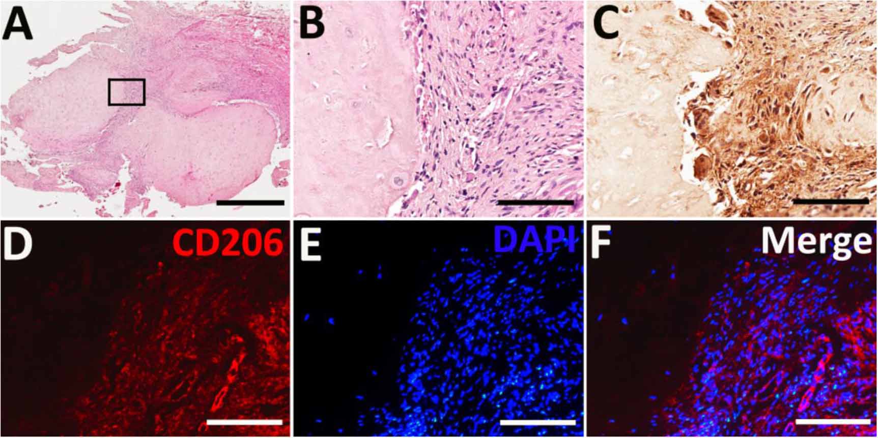Synovial macrophages in cartilage destruction and regeneration—lessons ...