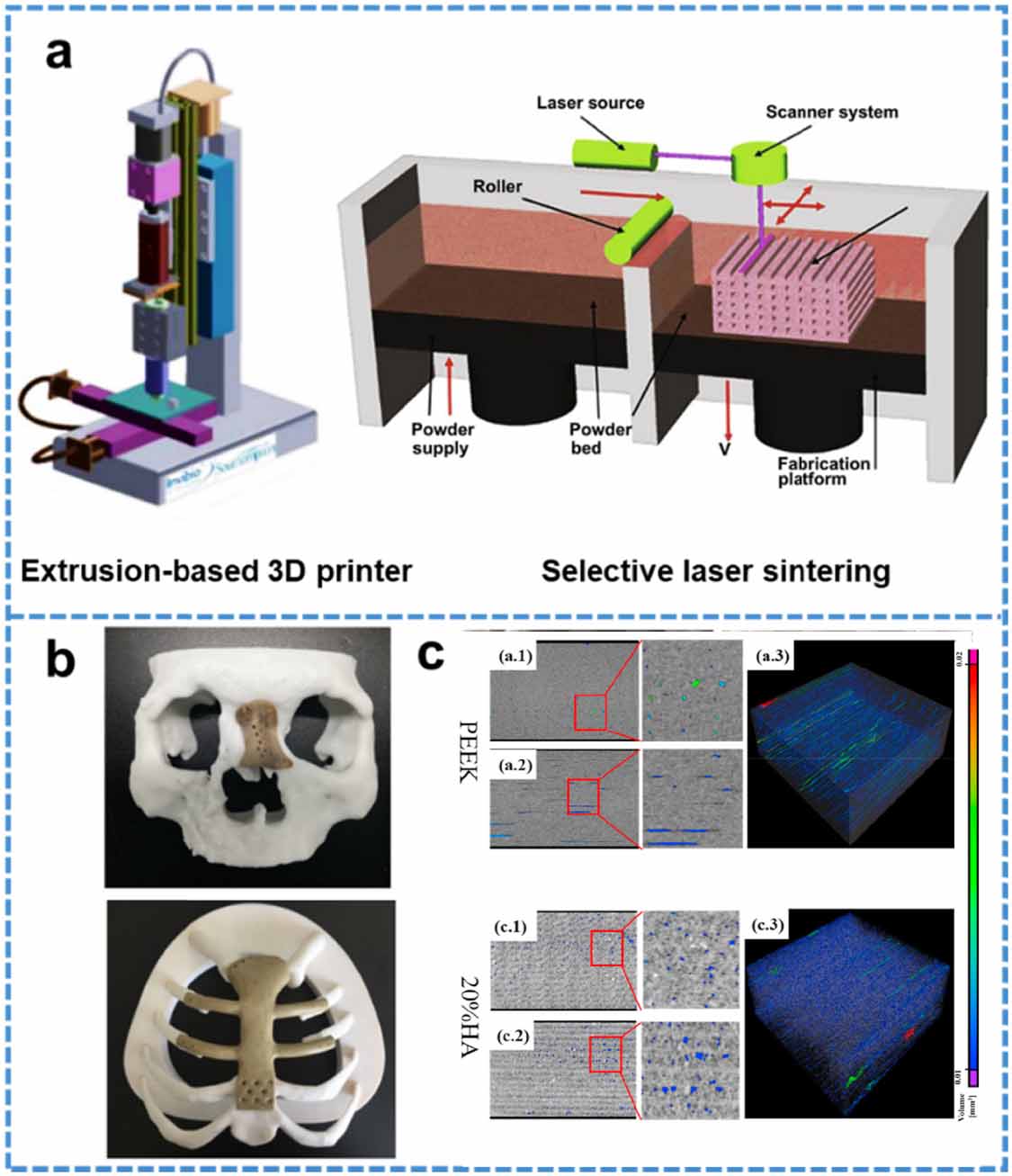 Modification of polyether ether ketone for the repairing of bone ...