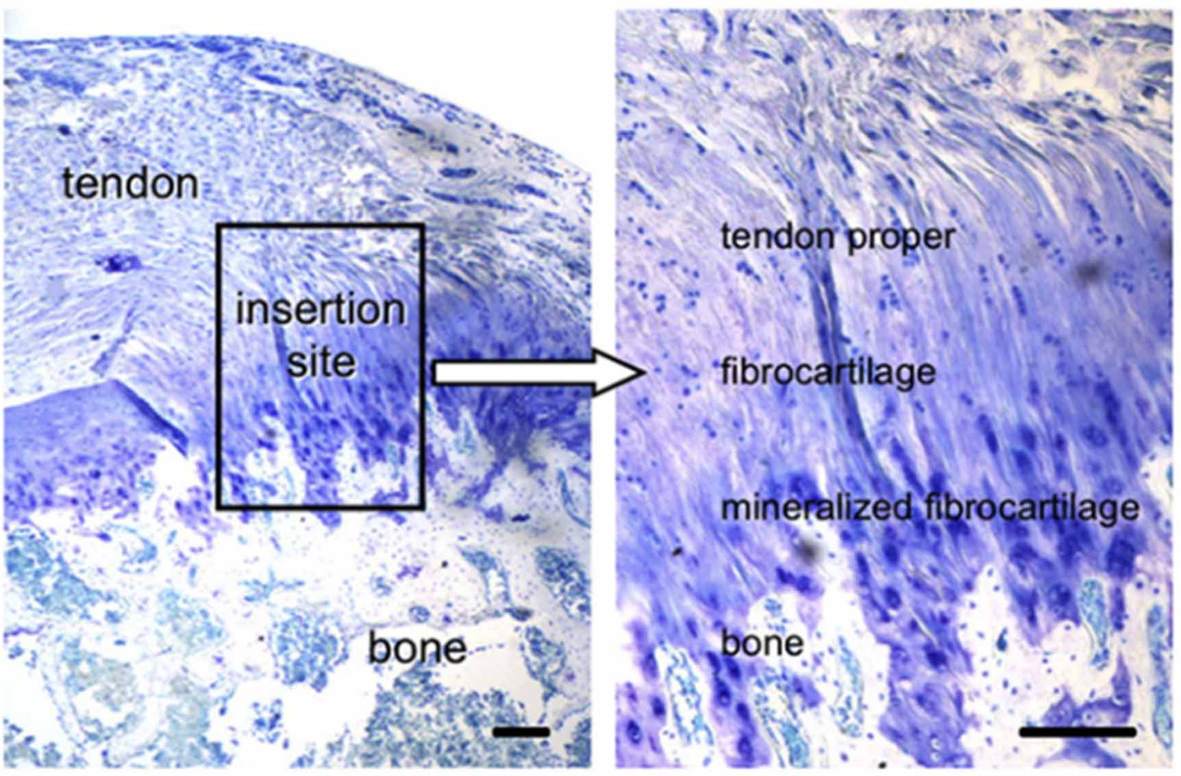 Biomaterials with stiffness gradient for interface tissue engineering ...