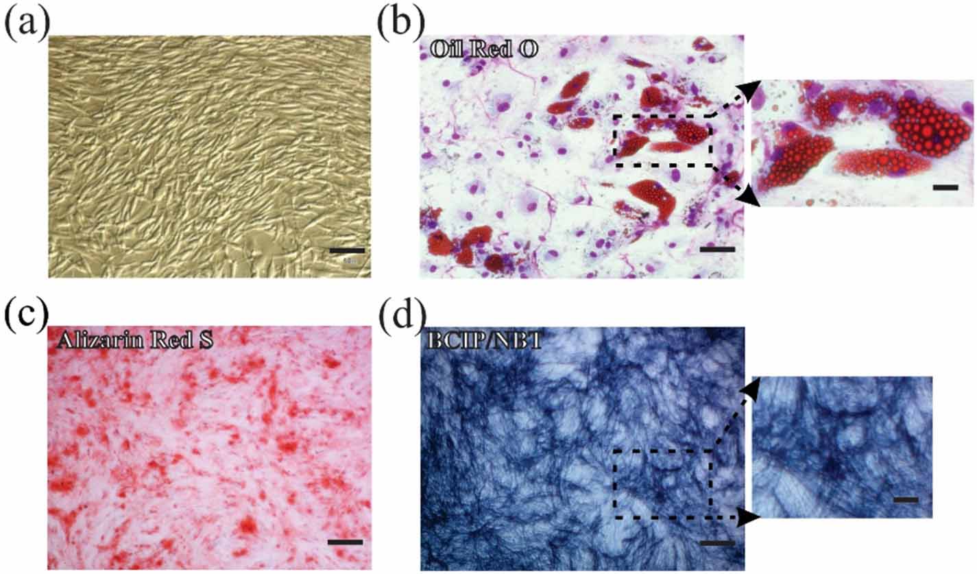 Heterogeneous pHPMA hydrogel promotes neuronal differentiation of bone ...