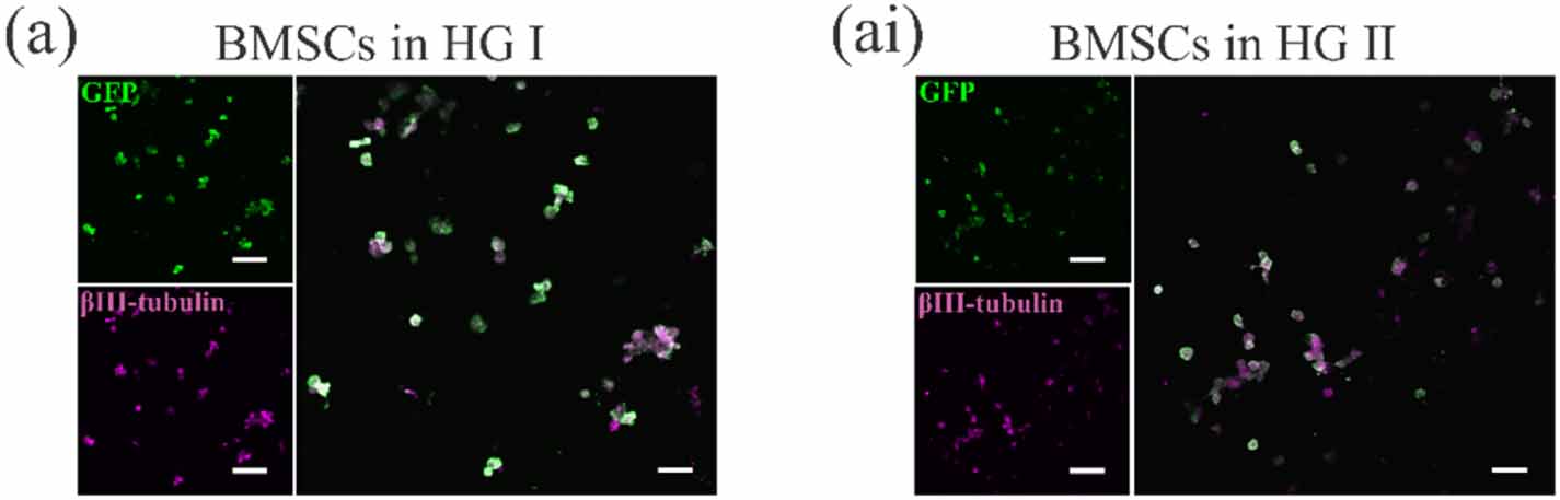 Heterogeneous pHPMA hydrogel promotes neuronal differentiation of bone ...