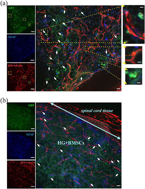 Heterogeneous pHPMA hydrogel promotes neuronal differentiation of bone ...