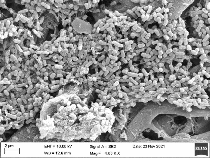 DRIVE 1993～2009～2026 -GLAY complete BEST Acceleration of Tissue Plasminogen Activator-Mediated