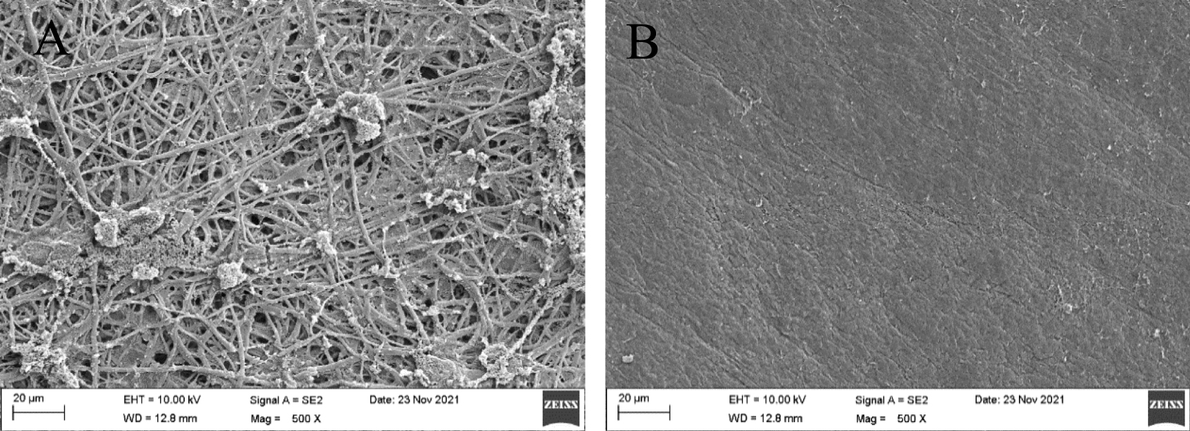 The chicken eggshell membrane: a versatile, sustainable