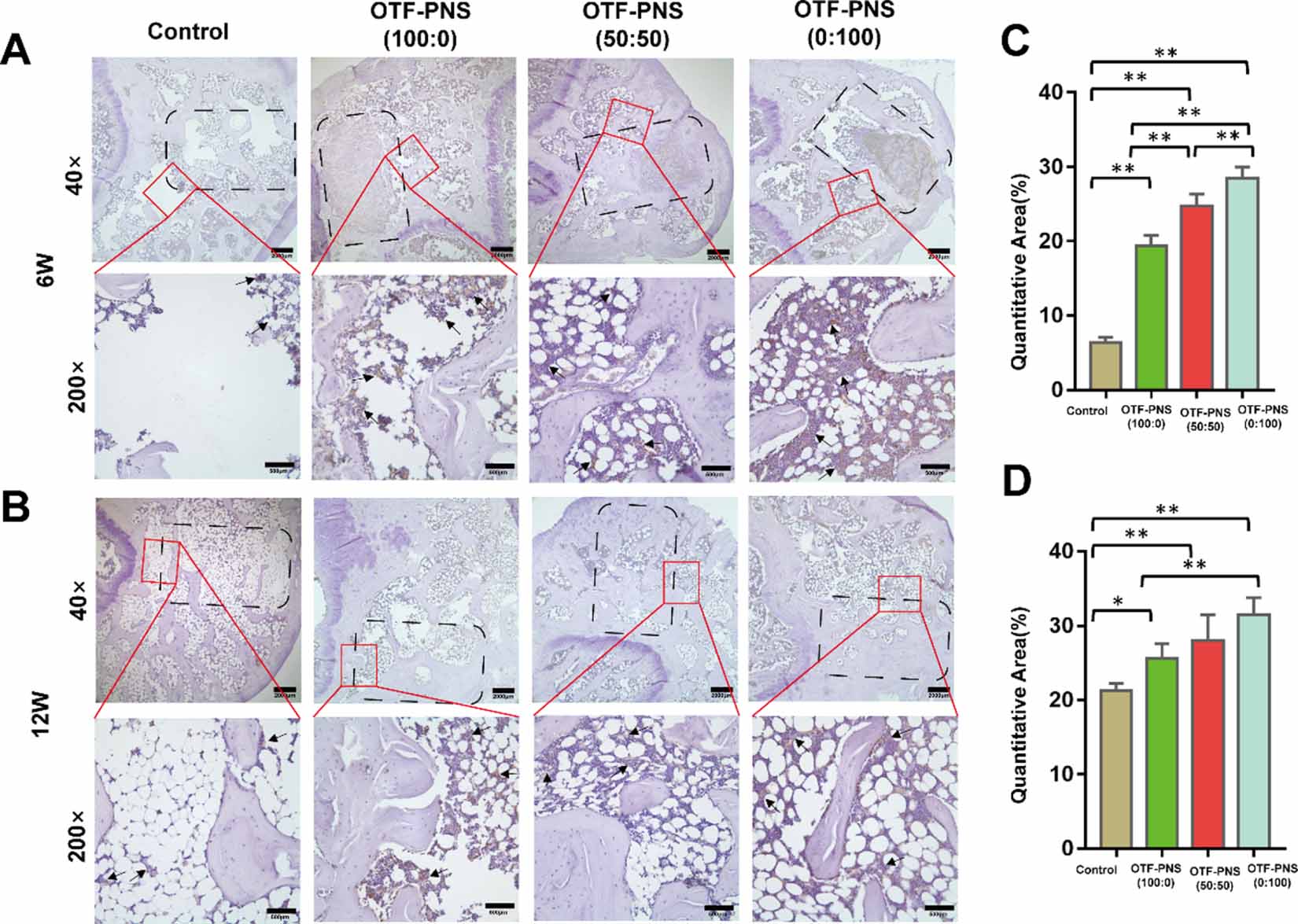 Angiogenesis coupled with osteogenesis in a bone tissue engineering ...