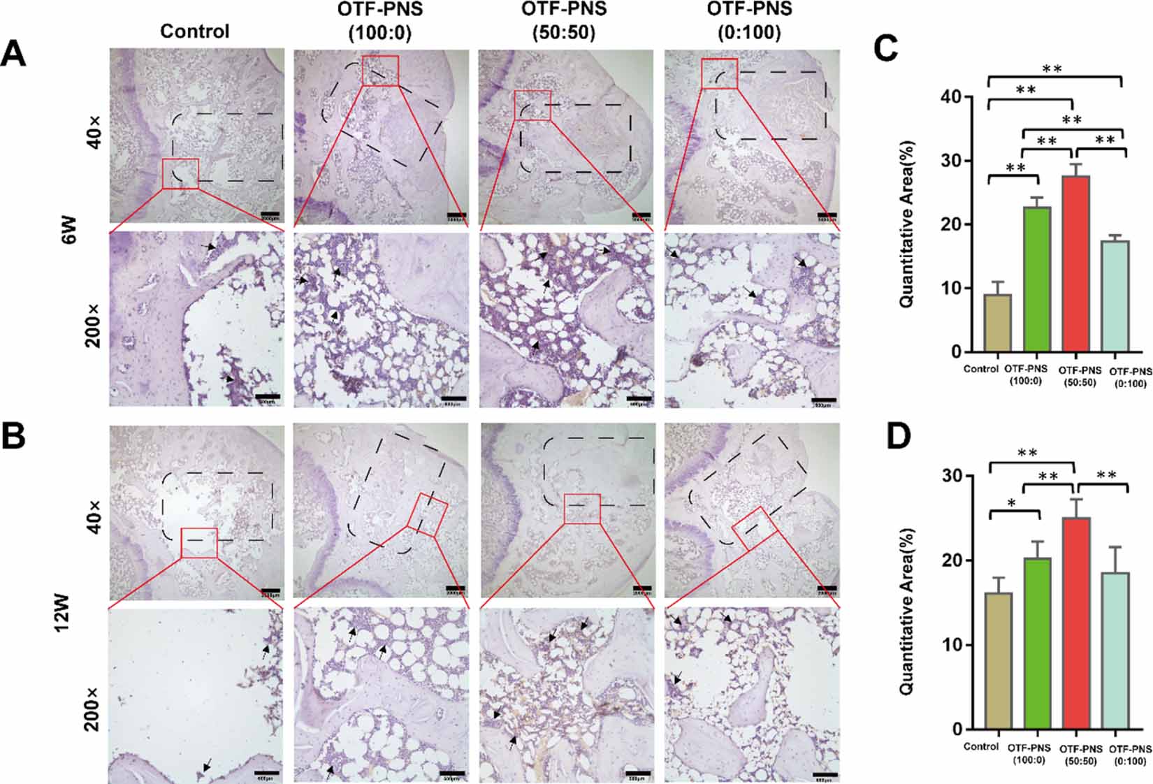 Angiogenesis coupled with osteogenesis in a bone tissue engineering ...
