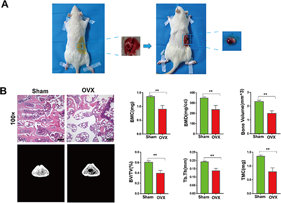 Angiogenesis coupled with osteogenesis in a bone tissue engineering ...