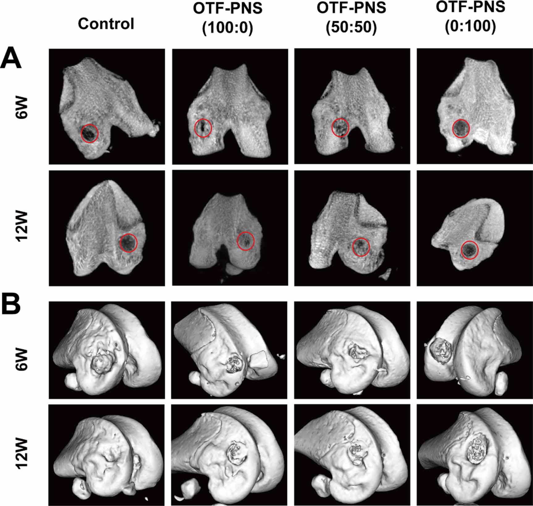 Angiogenesis coupled with osteogenesis in a bone tissue engineering ...