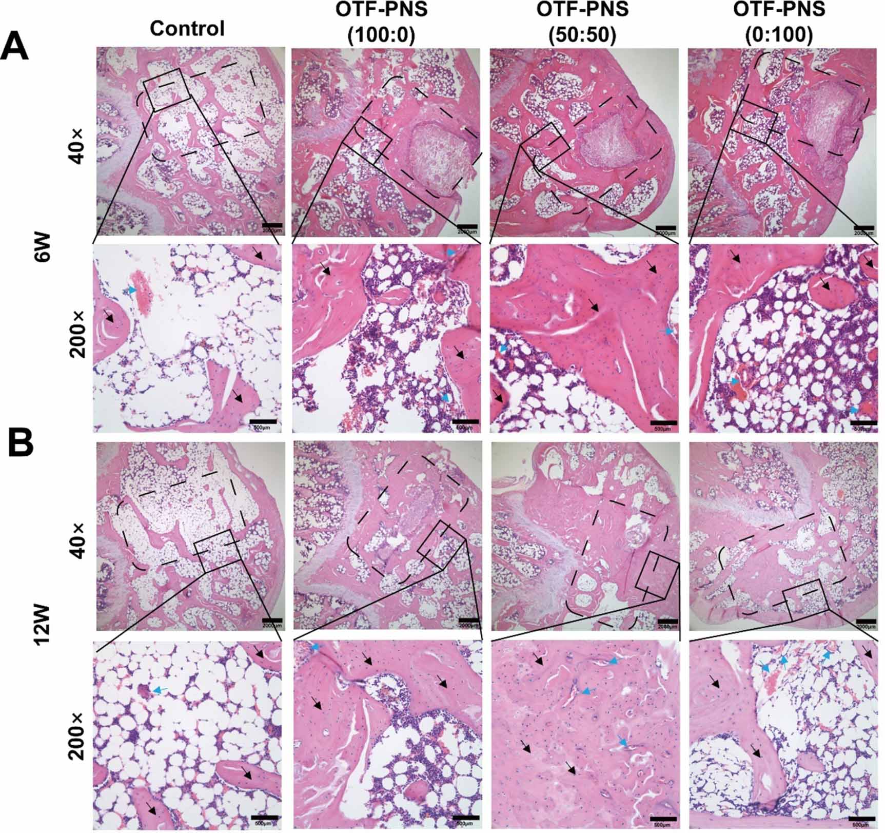Angiogenesis coupled with osteogenesis in a bone tissue engineering ...