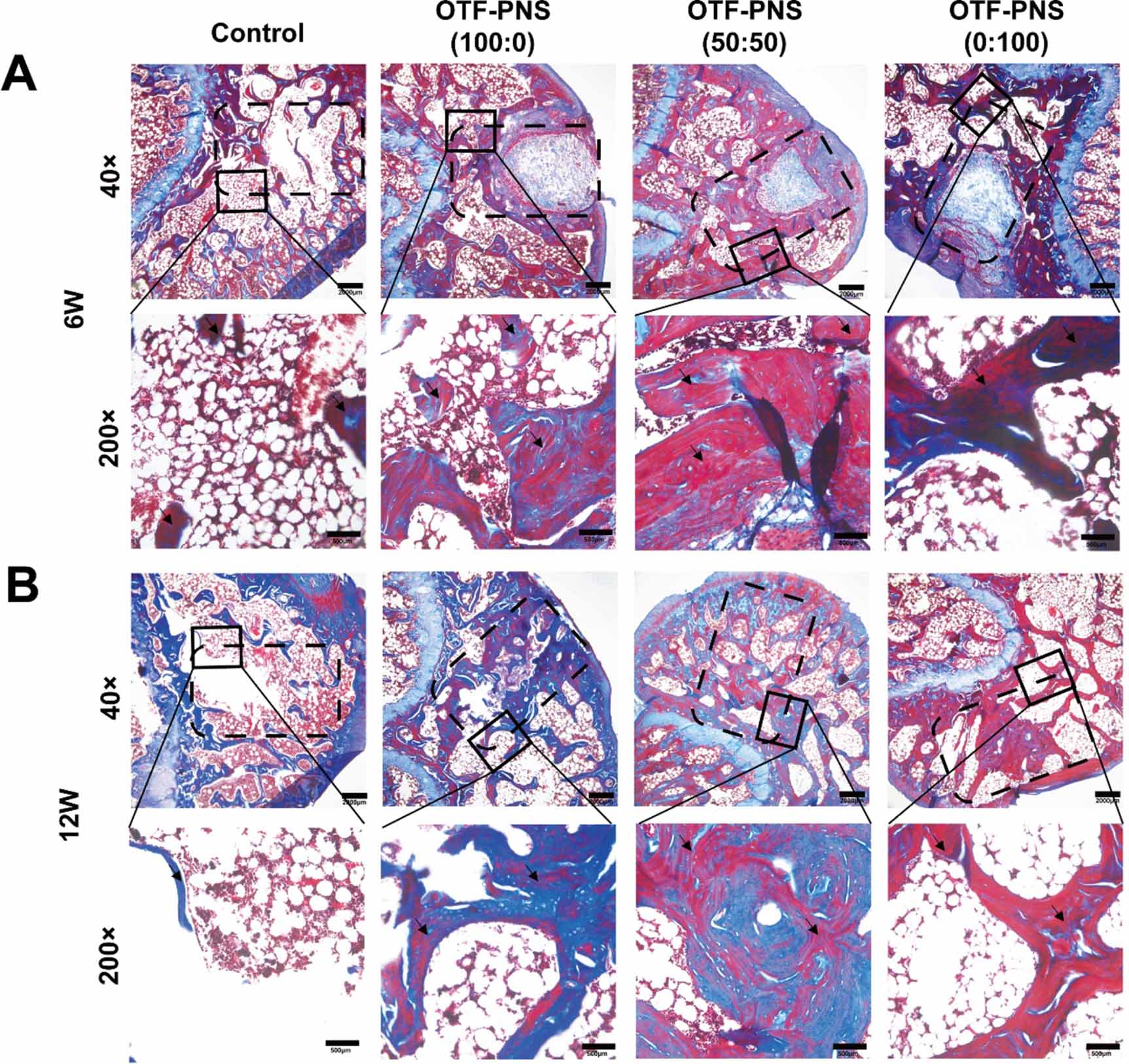 Angiogenesis coupled with osteogenesis in a bone tissue engineering ...
