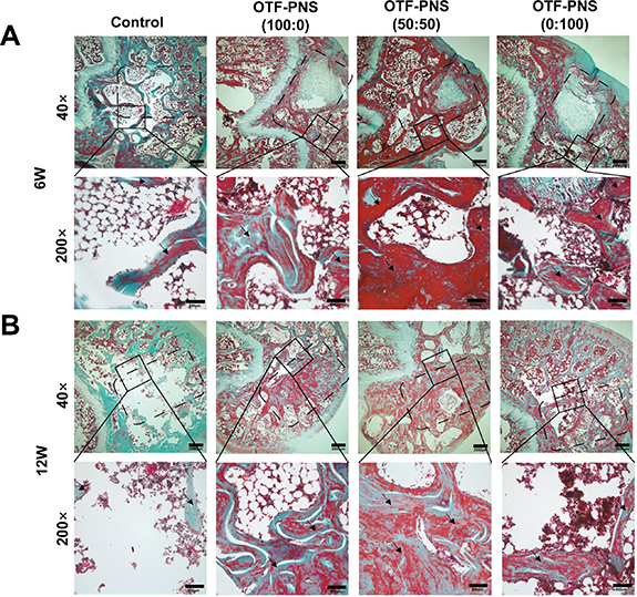Angiogenesis coupled with osteogenesis in a bone tissue engineering ...