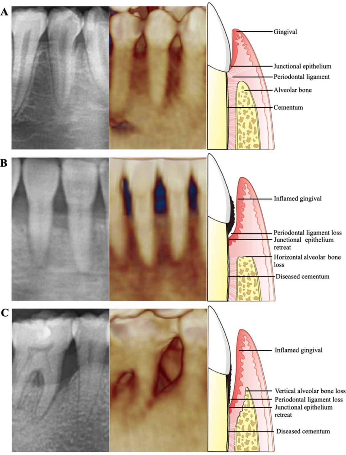 Recent advances in horizontal alveolar bone regeneration - IOPscience